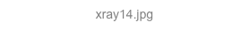xray14.jpg